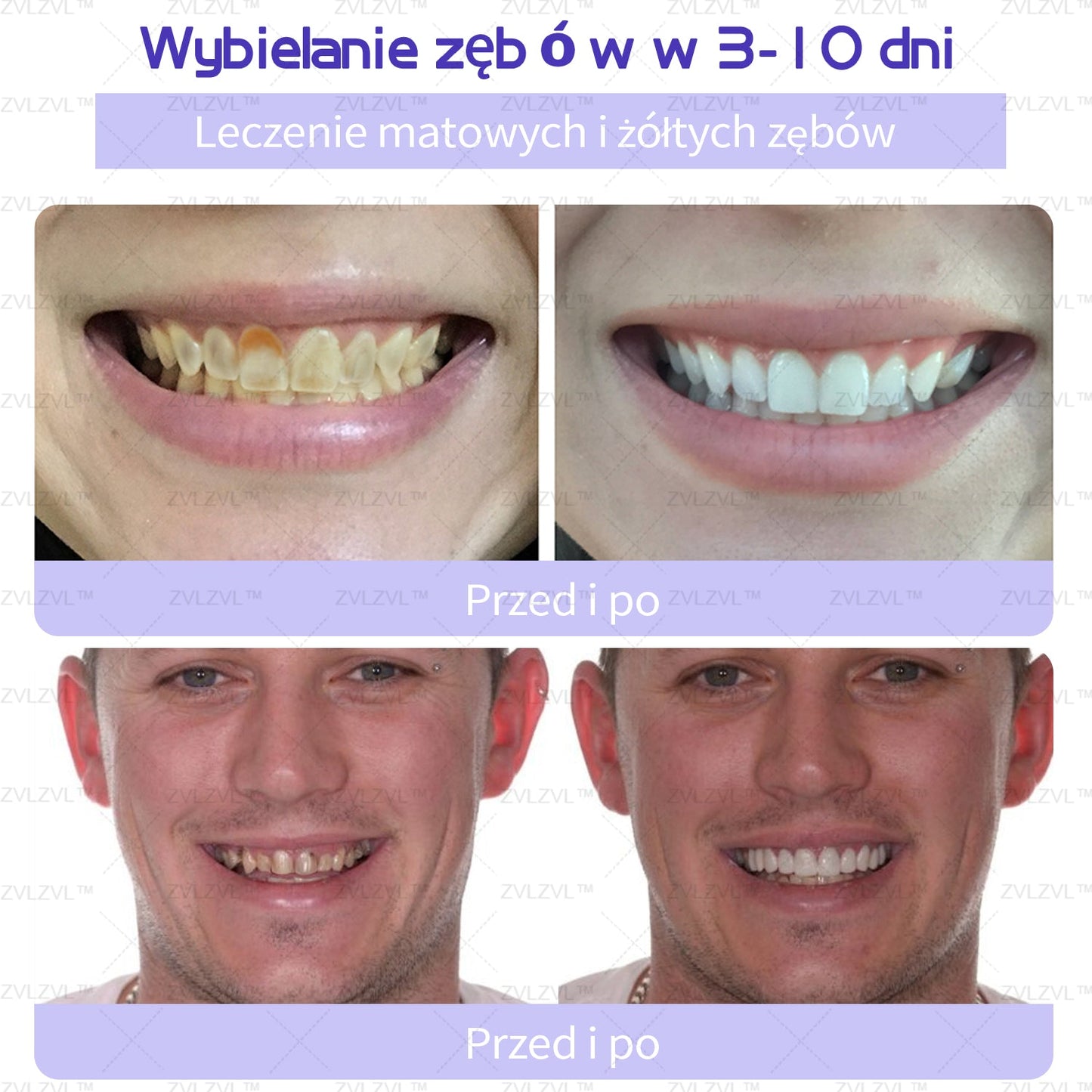 🎁 Zostało już tylko 5 pudełek! Zapewniamy również dodatkowy rabat 50%! Ciesz się białymi i zdrowymi zębami już teraz. Jeżeli przegapicie teraz, nadrobicie zaległości dopiero w przyszłym roku!