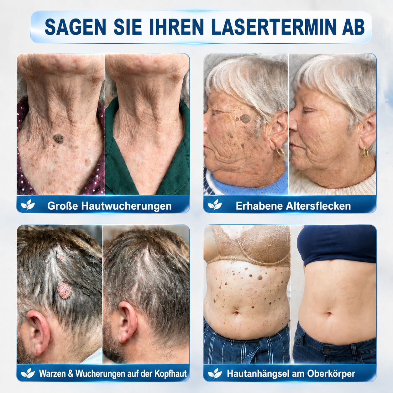 Herzlichen Glückwunsch! Sie haben ein exklusives 𝐇𝐈𝐒𝐊𝐈𝐍®-Angebot freigeschaltet! Als Dankeschön für Ihre Bestellung erhalten Sie heute zusätzlich 30 % Rabatt! Klicken Sie unten, um dieses Sonderangebot zu sichern – das Angebot gilt nur für kurze Zeit!