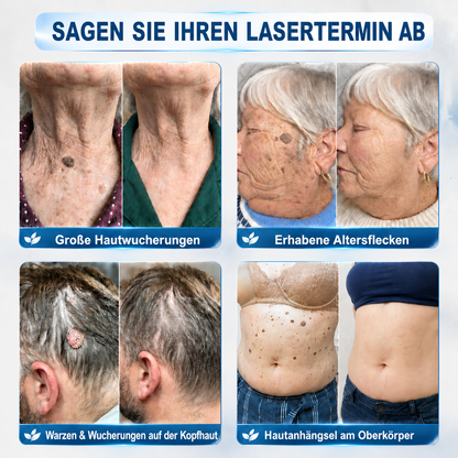Herzlichen Glückwunsch! Sie haben ein exklusives 𝐇𝐈𝐒𝐊𝐈𝐍®-Angebot freigeschaltet! Als Dankeschön für Ihre Bestellung erhalten Sie heute zusätzlich 30 % Rabatt! Klicken Sie unten, um dieses Sonderangebot zu sichern – das Angebot gilt nur für kurze Zeit!