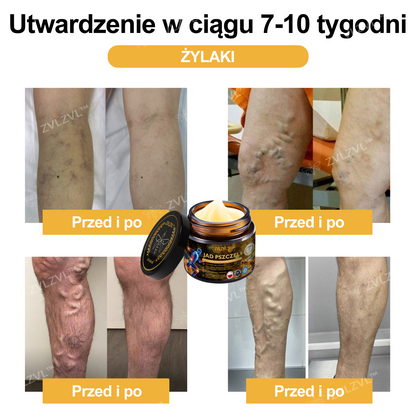 🎁 Zostało już tylko 5 pudełek! Dajemy Ci również dodatkowy rabat 50%! Szybko łagodzi ból i likwiduje stany zapalne stawów. Jeśli przegapisz teraz, otrzymasz ją dopiero w przyszłym roku.