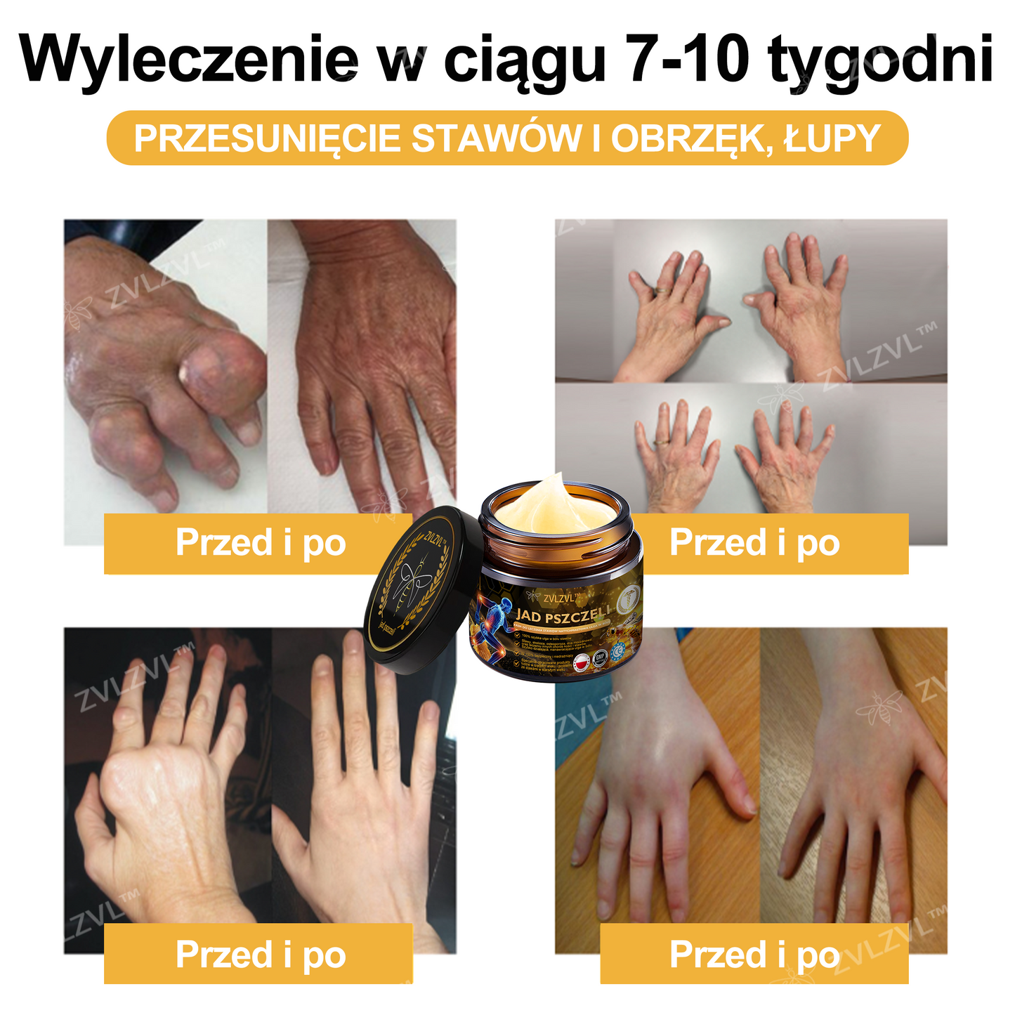 🎁 Zostało już tylko 5 pudełek! Dajemy Ci również dodatkowy rabat 50%! Szybko łagodzi ból i likwiduje stany zapalne stawów. Jeśli przegapisz teraz, otrzymasz ją dopiero w przyszłym roku.