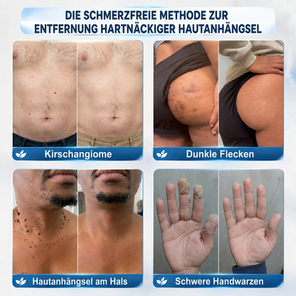 Herzlichen Glückwunsch! Sie haben ein exklusives 𝐇𝐈𝐒𝐊𝐈𝐍®-Angebot freigeschaltet! Als Dankeschön für Ihre Bestellung erhalten Sie heute zusätzlich 30 % Rabatt! Klicken Sie unten, um dieses Sonderangebot zu sichern – das Angebot gilt nur für kurze Zeit!