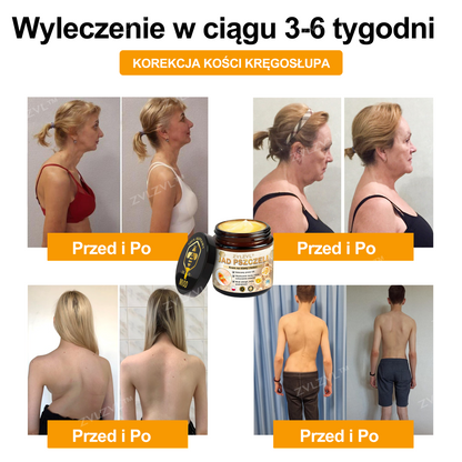 🎁💪 Ostatnia szansa! Zgarnij to szczęśliwe znalezisko z 70% ZNIŻKĄ!