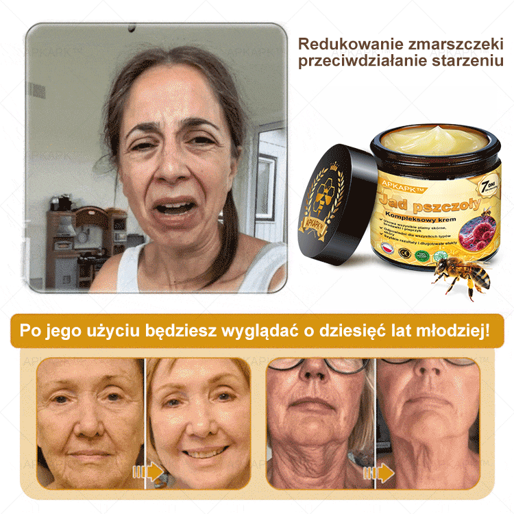 ΑPΚΑPK™Jad Pszczoły Kompleksowy Krem🧑‍⚕️🧑‍⚕️ 🥇pomaga w leczeniu problemów skórnych, takich jak: zmarszczki, blizny, plamy pigmentacyjne, rozstępy, trądzik, łuszczyca, egzema, zmiany skórne, podrażnienia, stany zapalne i inne problemy skórne🔥