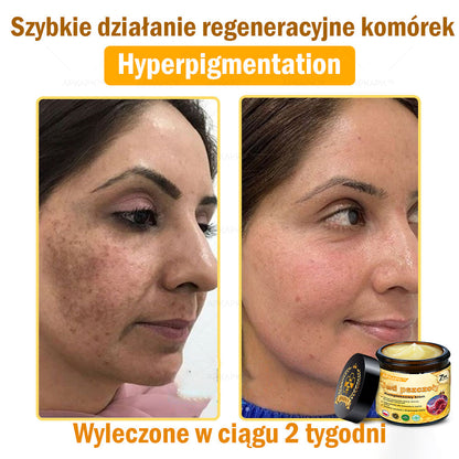 ΑPΚΑPK™Jad Pszczoły Kompleksowy Krem🧑‍⚕️🧑‍⚕️ 🥇pomaga w leczeniu problemów skórnych, takich jak: zmarszczki, blizny, plamy pigmentacyjne, rozstępy, trądzik, łuszczyca, egzema, zmiany skórne, podrażnienia, stany zapalne i inne problemy skórne🔥