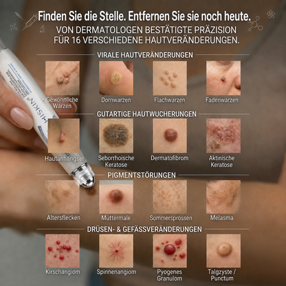Herzlichen Glückwunsch! Sie haben ein exklusives 𝐇𝐈𝐒𝐊𝐈𝐍®-Angebot freigeschaltet! Als Dankeschön für Ihre Bestellung erhalten Sie heute zusätzlich 30 % Rabatt! Klicken Sie unten, um dieses Sonderangebot zu sichern – das Angebot gilt nur für kurze Zeit!