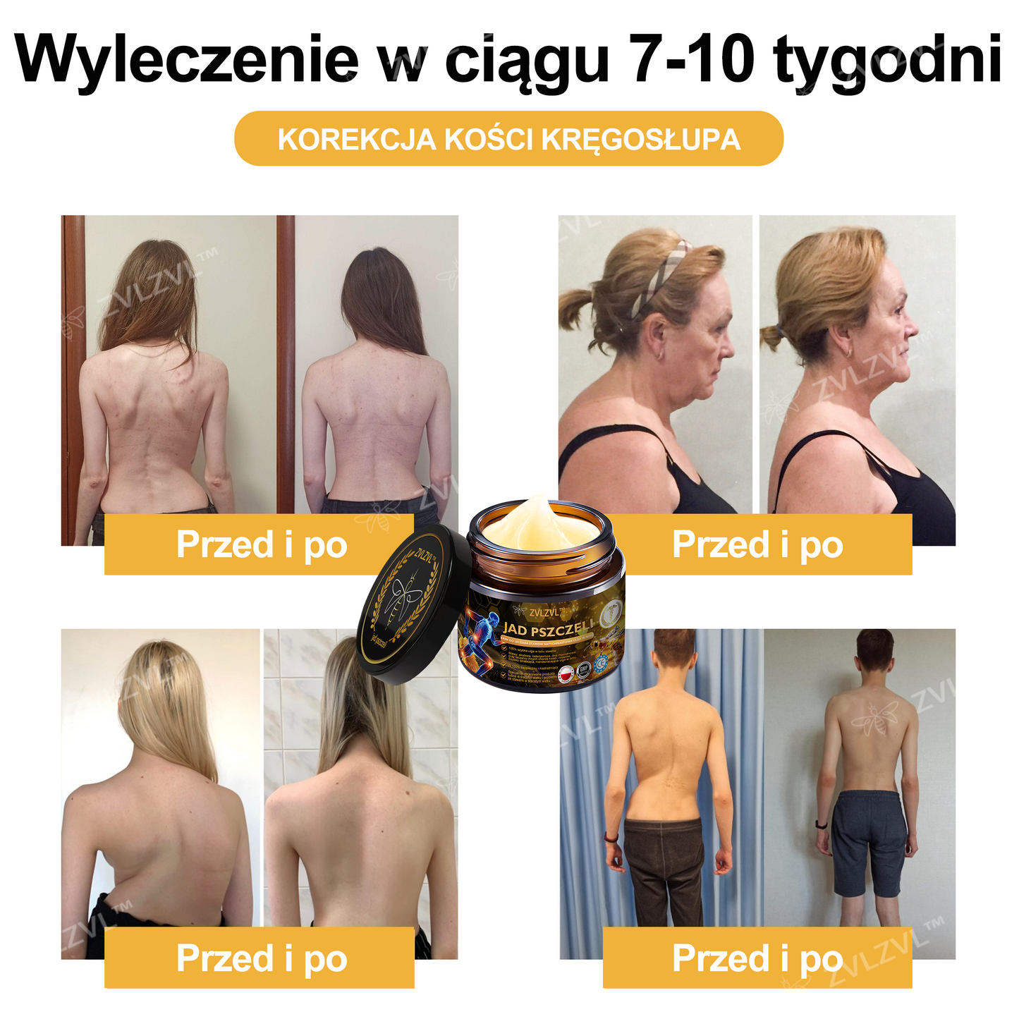 🎁 Zostało już tylko 5 pudełek! Dajemy Ci również dodatkowy rabat 50%! Szybko łagodzi ból i likwiduje stany zapalne stawów. Jeśli przegapisz teraz, otrzymasz ją dopiero w przyszłym roku.