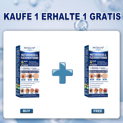 Herzlichen Glückwunsch! Sie haben ein exklusives 𝐇𝐈𝐒𝐊𝐈𝐍®-Angebot freigeschaltet! Als Dankeschön für Ihre Bestellung erhalten Sie heute zusätzlich 30 % Rabatt! Klicken Sie unten, um dieses Sonderangebot zu sichern – das Angebot gilt nur für kurze Zeit!