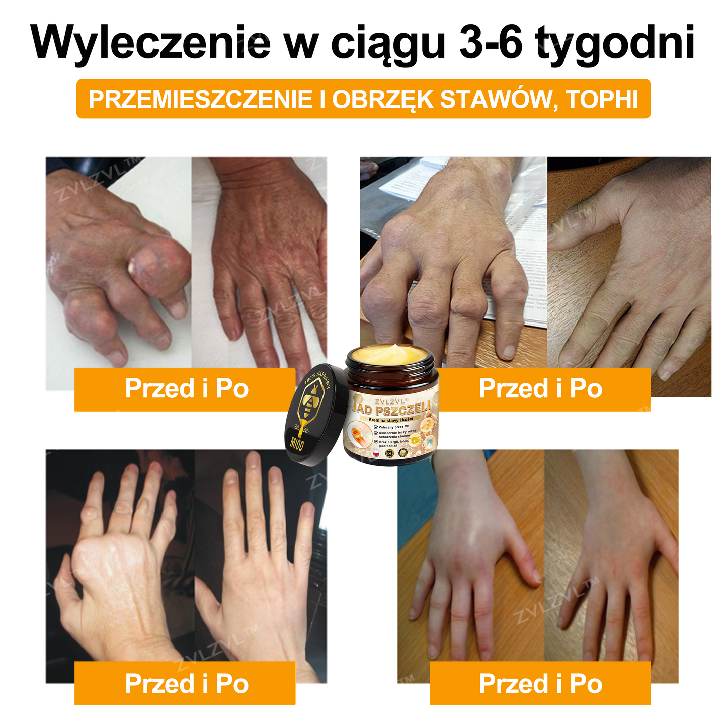 🎁💪 Ostatnia szansa! Zgarnij to szczęśliwe znalezisko z 70% ZNIŻKĄ!