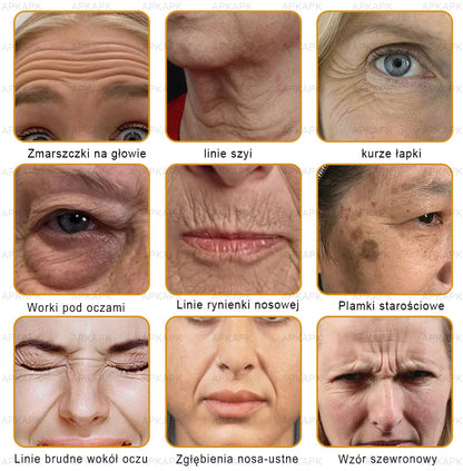 ΑPΚΑPK™Jad Pszczoły Kompleksowy Krem🧑‍⚕️🧑‍⚕️ 🥇pomaga w leczeniu problemów skórnych, takich jak: zmarszczki, blizny, plamy pigmentacyjne, rozstępy, trądzik, łuszczyca, egzema, zmiany skórne, podrażnienia, stany zapalne i inne problemy skórne🔥